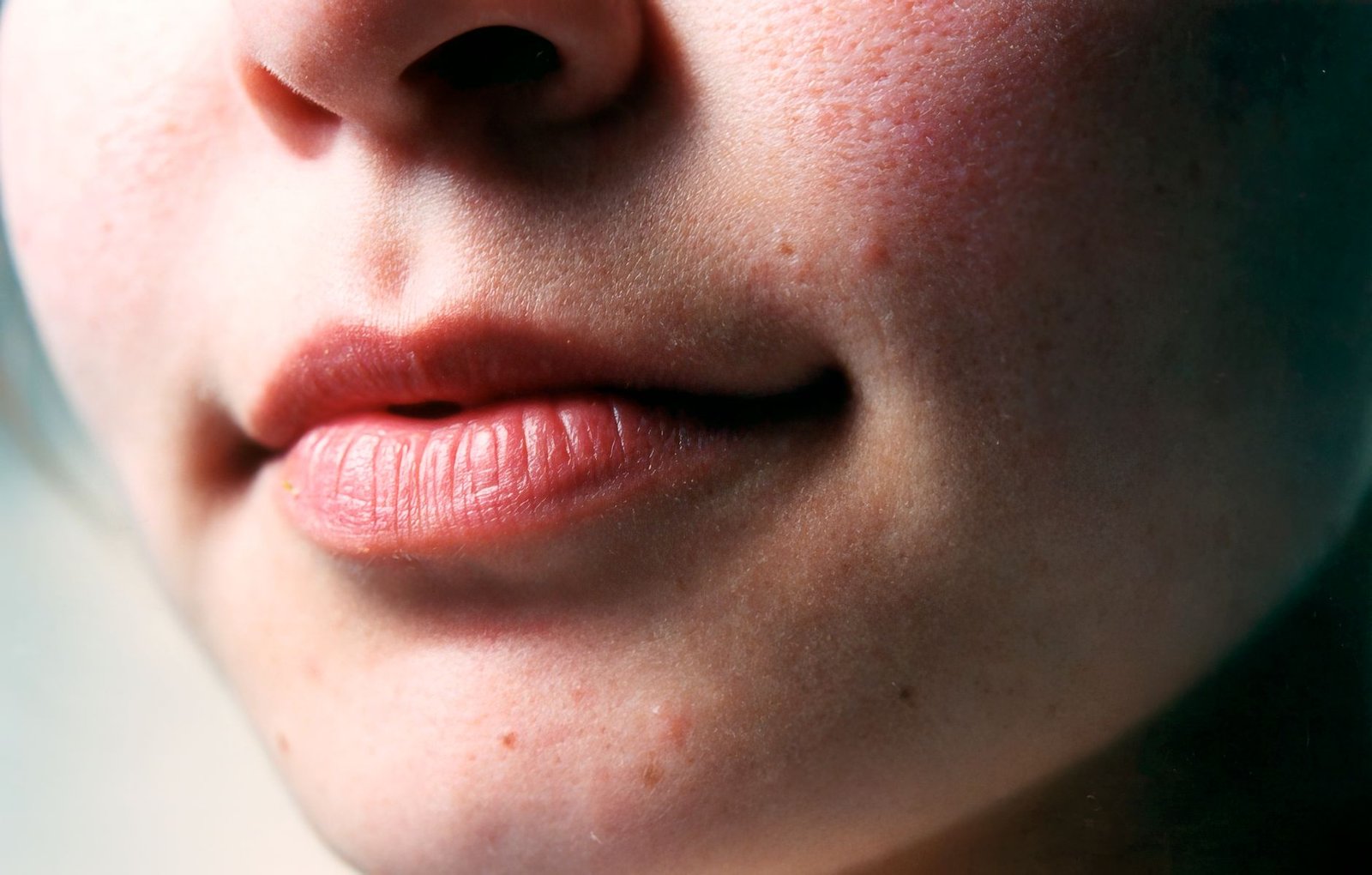 Dryness is the actual problem most lip products are bought for