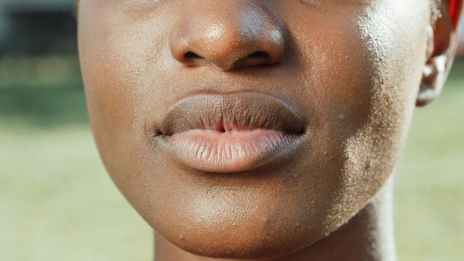 The midday shine niacinamide is most often bought to deal with
