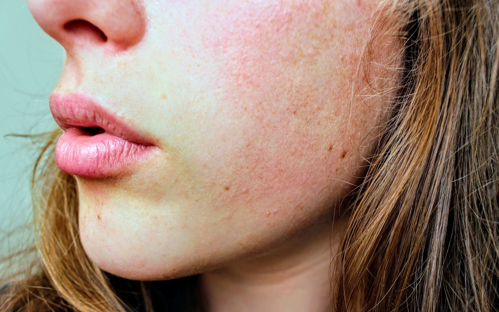 It works inside the pore rather than on the surface